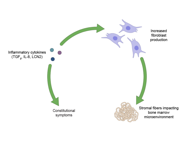 A diagram showing that inflammatory cytokines lead to constitutional symptoms, increased fibroblast production and stromal fibers that impact the bone marrow microenvironment in myelofibrosis